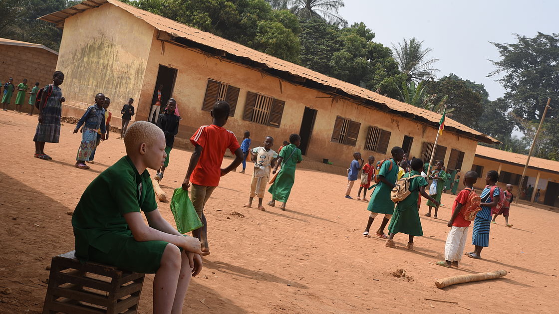 This photo shows Assan sitting in the shade while his friends play football in the sun.